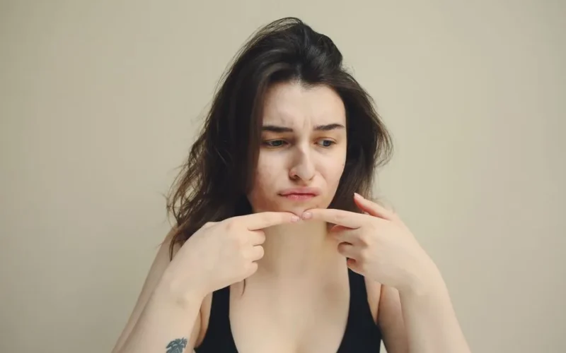 A woman looks at her skin with concern, touching her chin, worried about acne.